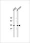 Calcium Binding Protein 39 antibody, M08197, Boster Biological Technology, Western Blot image 