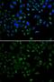 Chromobox 8 antibody, GTX53929, GeneTex, Immunofluorescence image 