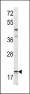 BCL2 Associated Agonist Of Cell Death antibody, TA324514, Origene, Western Blot image 