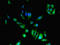 Cytidine deaminase antibody, LS-C210982, Lifespan Biosciences, Immunofluorescence image 