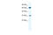 Potassium Calcium-Activated Channel Subfamily N Member 1 antibody, 28-240, ProSci, Western Blot image 