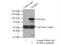 Serine/threonine-protein kinase MARK1 antibody, 21552-1-AP, Proteintech Group, Immunoprecipitation image 