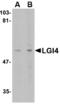 Leucine Rich Repeat LGI Family Member 4 antibody, A12305, Boster Biological Technology, Western Blot image 
