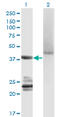 G Protein Subunit Alpha 14 antibody, LS-C134004, Lifespan Biosciences, Western Blot image 