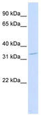 Homeobox protein OTX2 antibody, TA330539, Origene, Western Blot image 