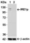 Serine/threonine-protein kinase/endoribonuclease IRE1 antibody, GTX30005, GeneTex, Western Blot image 