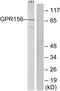 G Protein-Coupled Receptor 156 antibody, GTX87902, GeneTex, Western Blot image 