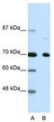 Nuclear Receptor Corepressor 2 antibody, TA330553, Origene, Western Blot image 