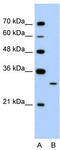 EGF Like Domain Multiple 8 antibody, TA329485, Origene, Western Blot image 
