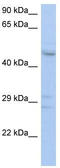 2-Phosphoxylose Phosphatase 1 antibody, TA336013, Origene, Western Blot image 