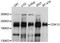 Cyclin-dependent kinase 13 antibody, STJ112296, St John