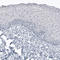 Angiotensin I Converting Enzyme 2 antibody, AMAb91259, Atlas Antibodies, Immunohistochemistry frozen image 