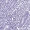 Spermatogenesis Associated 16 antibody, HPA037884, Atlas Antibodies, Immunohistochemistry paraffin image 