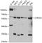 Cytochrome P450 Family 2 Subfamily C Member 9 antibody, A00465-1, Boster Biological Technology, Western Blot image 