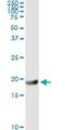 Ftl antibody, H00002512-M18, Novus Biologicals, Immunoprecipitation image 