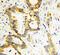 Baculoviral IAP Repeat Containing 7 antibody, PA1427, Boster Biological Technology, Immunohistochemistry paraffin image 