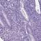 HHIP Like 2 antibody, HPA059673, Atlas Antibodies, Immunohistochemistry paraffin image 