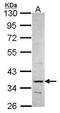 Phosphoribosyl Pyrophosphate Synthetase 2 antibody, TA308129, Origene, Western Blot image 