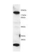 5-Methyltetrahydrofolate-Homocysteine Methyltransferase antibody, NB100-791, Novus Biologicals, Western Blot image 