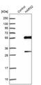 Histidyl-TRNA Synthetase 2, Mitochondrial antibody, PA5-57474, Invitrogen Antibodies, Western Blot image 