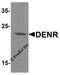 Density Regulated Re-Initiation And Release Factor antibody, 7755, ProSci Inc, Western Blot image 
