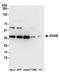 Isocitrate Dehydrogenase (NAD(+)) 3 Beta antibody, A305-500A, Bethyl Labs, Western Blot image 