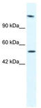 DNA Helicase B antibody, TA341626, Origene, Western Blot image 