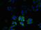 Chloride Intracellular Channel 2 antibody, orb23296, Biorbyt, Immunocytochemistry image 