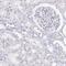 Late Cornified Envelope 6A antibody, PA5-61230, Invitrogen Antibodies, Immunohistochemistry frozen image 