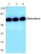 Clusterin antibody, A00590-1, Boster Biological Technology, Western Blot image 