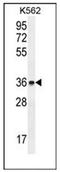 ETS translocation variant 2 antibody, AP51472PU-N, Origene, Western Blot image 