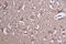 Zinc Finger DHHC-Type Containing 12 antibody, CSB-PA822219LA01HU, Cusabio, Immunohistochemistry paraffin image 