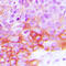 EGFR antibody, abx133133, Abbexa, Western Blot image 