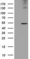 Lipoprotein Lipase antibody, TA503783, Origene, Western Blot image 
