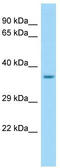 Selectin P Ligand antibody, TA338244, Origene, Western Blot image 