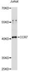 C-C Motif Chemokine Receptor 7 antibody, LS-C749698, Lifespan Biosciences, Western Blot image 