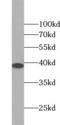 Transmembrane Protein 173 antibody, FNab08759, FineTest, Western Blot image 
