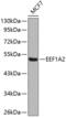 Eukaryotic Translation Elongation Factor 1 Alpha 2 antibody, 22-866, ProSci, Western Blot image 