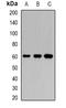 Karyopherin Subunit Alpha 6 antibody, LS-B14589, Lifespan Biosciences, Western Blot image 