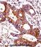Carcinoembryonic antigen-related cell adhesion molecule 7 antibody, abx029319, Abbexa, Immunohistochemistry paraffin image 