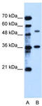Transmembrane Protein 8B antibody, TA346271, Origene, Western Blot image 