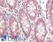 Phenylalanyl-TRNA Synthetase Subunit Alpha antibody, LS-C318281, Lifespan Biosciences, Immunohistochemistry paraffin image 