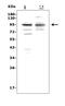 Premelanosome Protein antibody, A01262-2, Boster Biological Technology, Western Blot image 