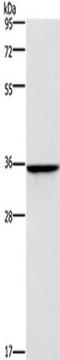 Homeobox B2 antibody, TA351256, Origene, Western Blot image 