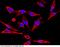 AMPS antibody, 11287-MM05, Sino Biological, Immunohistochemistry frozen image 