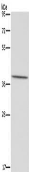 Mitochondrially Encoded NADH:Ubiquinone Oxidoreductase Core Subunit 1 antibody, TA351415, Origene, Western Blot image 
