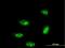 TP53 Regulating Kinase antibody, H00112858-M03, Novus Biologicals, Immunocytochemistry image 