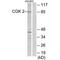 cGMP-dependent protein kinase 2 antibody, PA5-49822, Invitrogen Antibodies, Western Blot image 