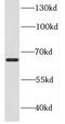 Probable ATP-dependent RNA helicase DDX52 antibody, FNab02315, FineTest, Western Blot image 