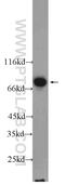 Ecto-NOX Disulfide-Thiol Exchanger 1 antibody, 23750-1-AP, Proteintech Group, Western Blot image 